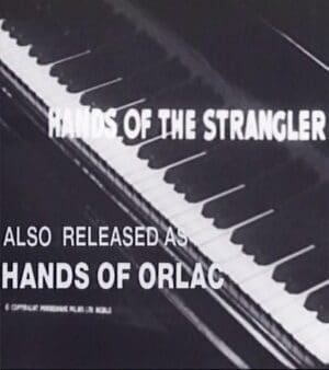 Hands Of Orlac Hands Of Orlac